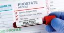 prostate cancer symptoms