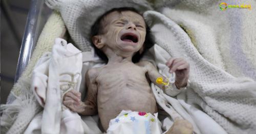 Syrian children die of hunger under regime siege