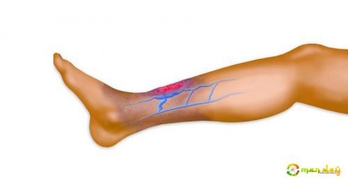 Do You Suffer From Poor Circulation? Here&rsquo;s How to Solve the Problem in Less Than 20 Minutes!