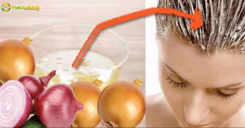 How To Use Onion To Prevent Hair Loss