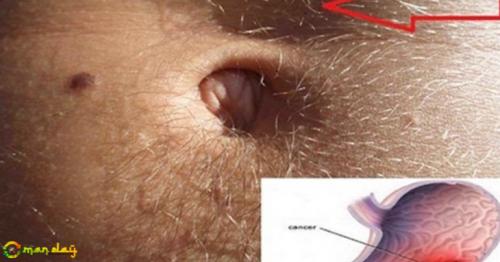 Cancer In The Stomach Develops Silently. These Are The First Signs! It Is Important That You Be Attentive!