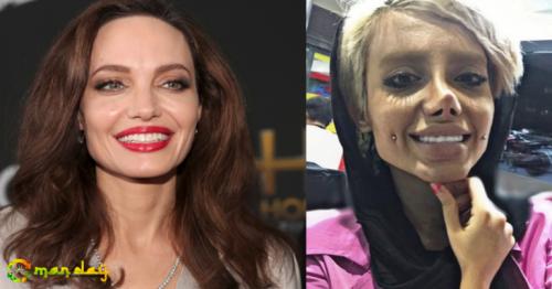 Instagram Starlet Gets 50 Plastic Operations to Look Like Angelina Jolie