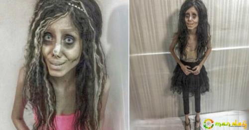 Angelina Jolie Wannabe Has Finally Spoken Out About Her Surgery After Being Condemned For Her Looks