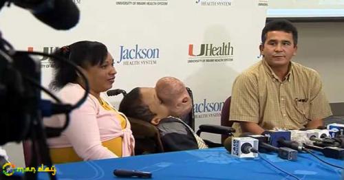 Doctors to remove basketball size tumour from boy&rsquo;s face