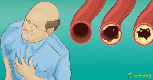12 Foods that You Should Eat Daily for Clean Arteries