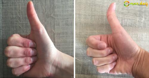Is Your Thumb Straight Or Crooked? Here Is What It Means!