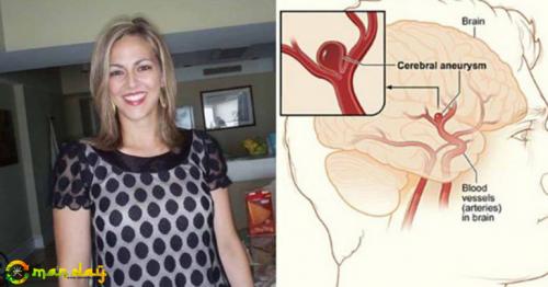 She Thought That It Was Just a Migraine. 2 Days Later, She Died - Doctors Now Warn the Public to Take Note About This Disease,s Symptoms Before It Is Too Late