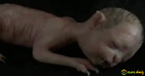 Police Have Been Forced To Deny That A ’’Human Cat’’ Has Been Found Wandering The Streets