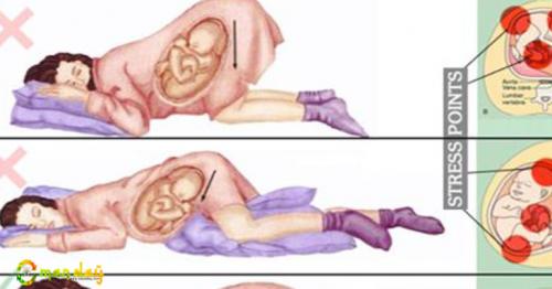 Hey You, Future Mom! You Are Sleeping Wrong, This Is The Correct Sleeping Position During Pregnancy?