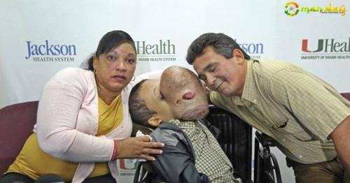 Boy with 10-pound tumour on face dies