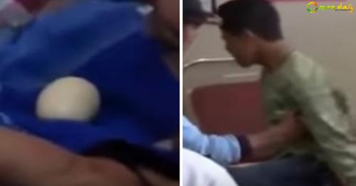 Teenage Boy &rsquo;Lays 20 Eggs Out of His Bum&rsquo; Leaving Doctors Baffled