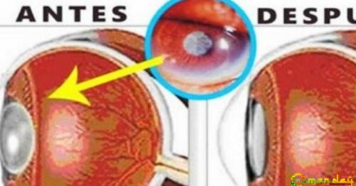 100% Natural Advice To Significantly Increase Your Vision