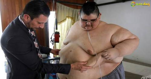 Mexican man, once the world&rsquo;s fattest, dreams of walking again
