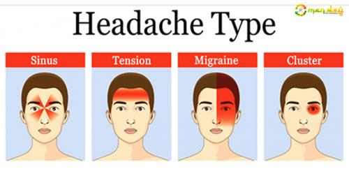 8 Types of Headaches and why it is important to take them seriously