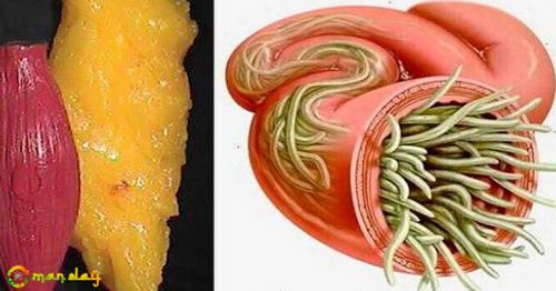 Just Use These 2 Ingredients To Empty All Deposits of Fat and Parasites Of Your Body Without Effort