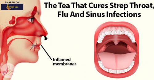 The Tea That Can Help Treat Strep Throat, Flu And Sinus Infections