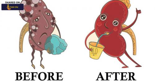 How to Flush Kidney Stones Naturally With Just 4 Ingredients