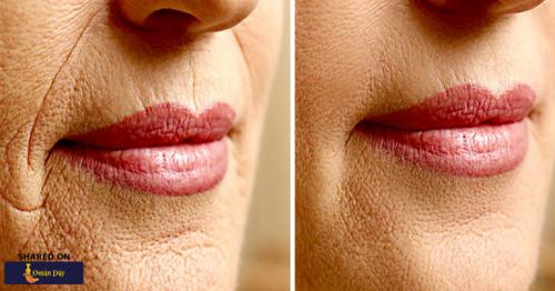 Science-Backed Remedies to Minimize Wrinkles and Look Younger