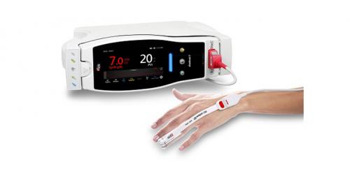 New Study Evaluates Ability of Masimo SpHb® (Noninvasive Hemoglobin) to Estimate Timing for Invasive Measurement to Detect Anemia During Surgery