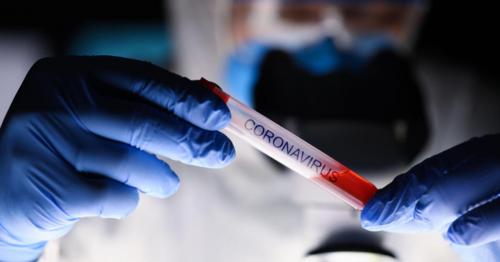 Global Coronavirus Death Count Tops 160,000: Report