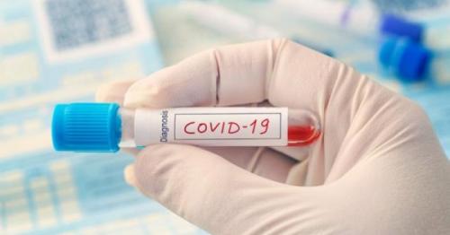 Pakistan’s Governor tests positive of COVID-19