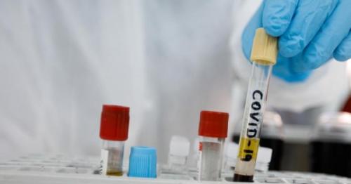 Coronavirus vaccine human tests show initial promise