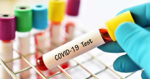 Mandatory PCR test for travellers with above normal temperature: Oman Airports