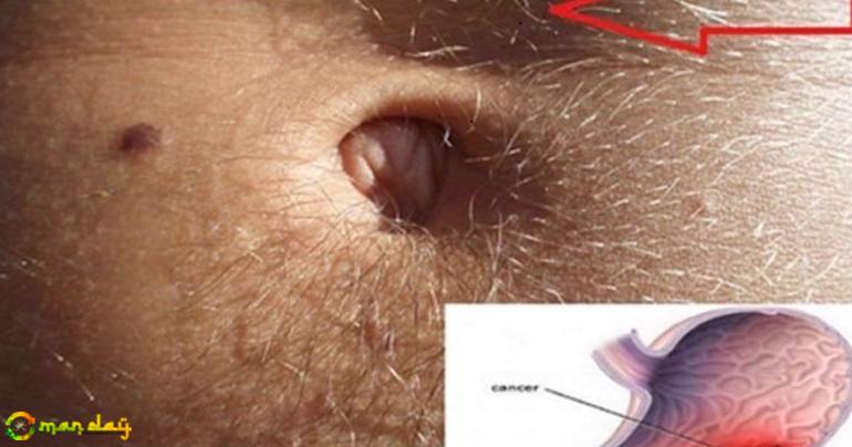 Cancer In The Stomach Develops Silently. These Are The First Signs! It Is Important That You Be Attentive!