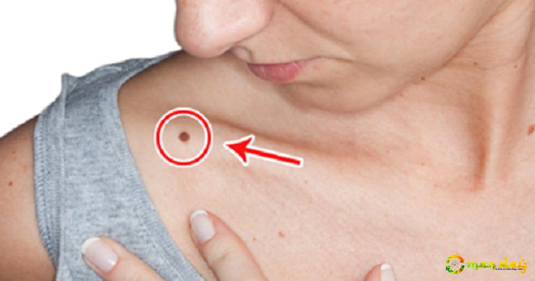 Early signs that cancer is growing in your body