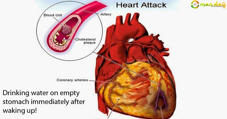 Drinking water on empty stomach immediately after waking up!