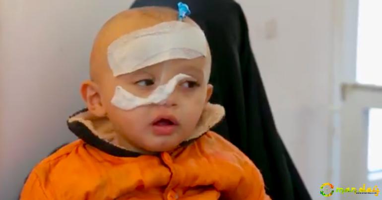The Saudi-US War on Yemen Is Killing 130 Children a Day and Other Bleak Statistics