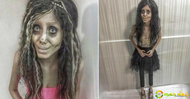 Angelina Jolie Wannabe Has Finally Spoken Out About Her Surgery After Being Condemned For Her Looks