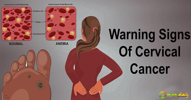 Warning Women: Never Ignore These 7 Signs of Cervical Cancer