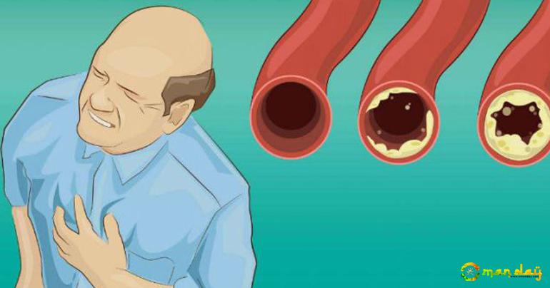 12 Foods that You Should Eat Daily for Clean Arteries