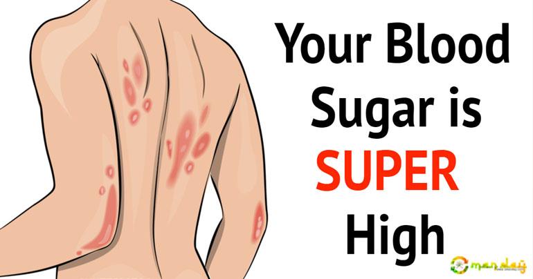14 Symptoms That Indicate High Blood Sugar Levels!