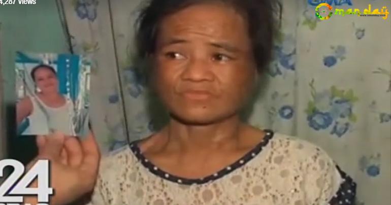 OFW From Jordan Suffered So Much Abuse From Employer For 1 Year, Returns Home With Bruises All Over Her Body