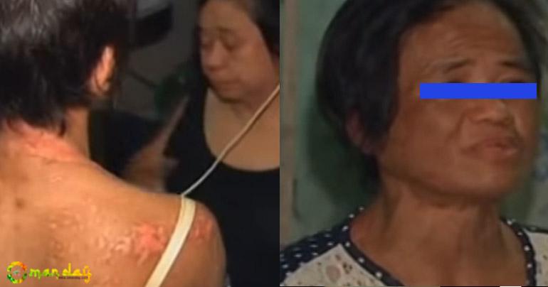 Filipina Abused by Employer for a Year, Returns Home with Stitches and Burns