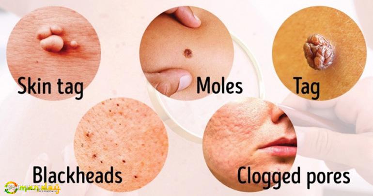 8 Serious Diseases Signaled by Our Skin