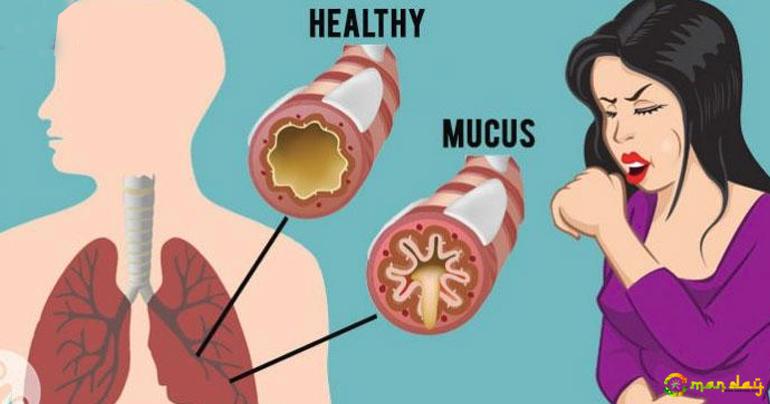 Remove Mucus And Phlegm From Your Throat & Chest (Instant Relief)!