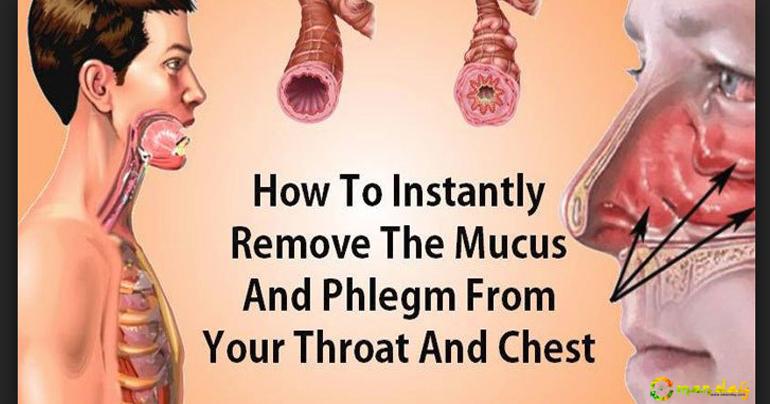 Eliminate the Phlegm and the Mucus From Your Chest and Throat