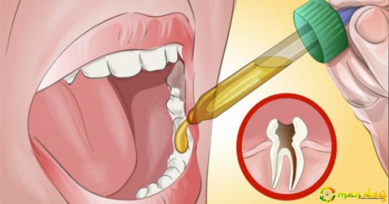 Use This Remedy to Alleviate Toothaches
