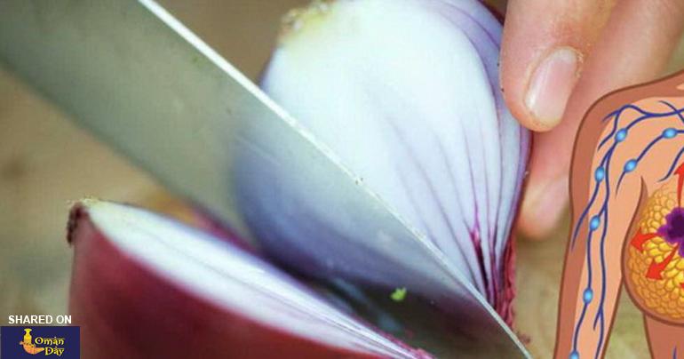 Onions To Fight Cancer
