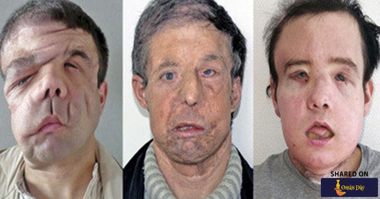 Meet Jerome Hamon, The "man with three faces"