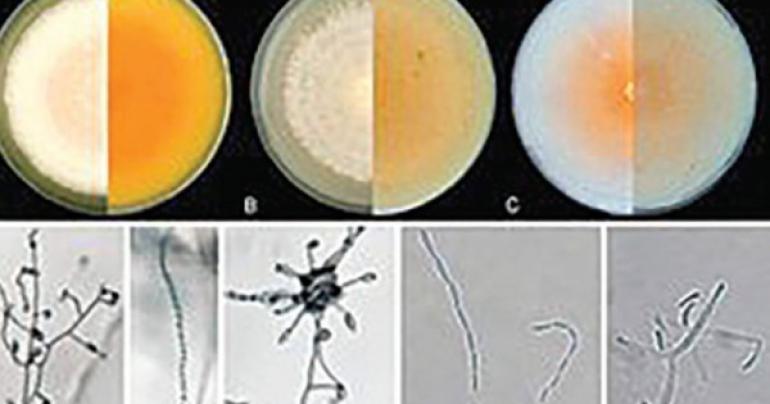 New fungus strain discovered inside human body, The Ministry of Health Oman, latest health news, Oman Health news, Dr Abdullah Al Hatmi, a senior specialist microbiologist and lab researcher at the Directorate General for Health Services in Al Dhahir