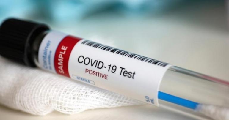 1067 new coronavirus cases reported in Oman