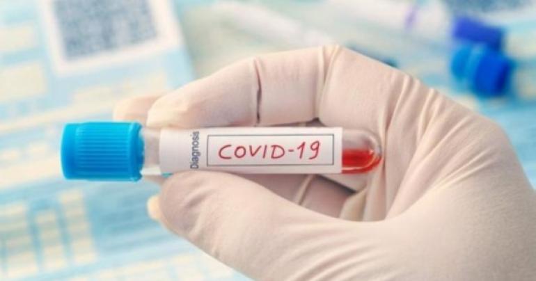 Nine new COVID-19 deaths registered in Oman