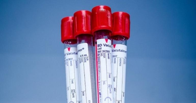 Blood bank in Oman issues urgent appeal for O+ blood