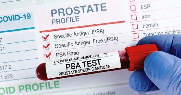 prostate cancer symptoms