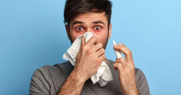 who gets allergies